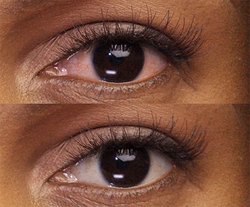 Before and after shot of an eye after using Lumify eye drops
